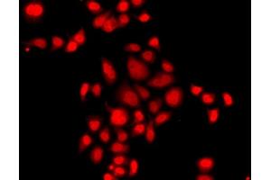 Immunofluorescence analysis of  cells using MLF1 antibody (ABIN6128238, ABIN6143875, ABIN6143877 and ABIN6224035). (MLF1 anticorps  (AA 1-268))
