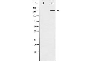 Western blot analysis of EGFR phosphorylation expression in A431 whole cell lysates,The lane on the left is treated with the antigen-specific peptide. (EGFR anticorps  (pThr693))