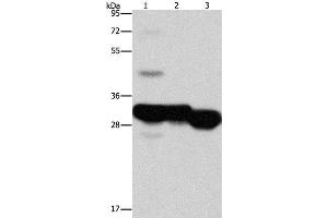 Western Blot analysis of Mouse liver and kidney tissue, Human fetal liver tissue using KHK Polyclonal Antibody at dilution of 1:1250 (Ketohexokinase anticorps)