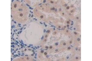 IHC-P analysis of Human Tissue, with DAB staining. (NKRF anticorps  (AA 1-296))