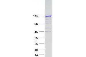 Validation with Western Blot