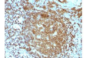 Formalin-fixed, paraffin-embedded human Tonsil stained with CD45RA Mouse Monoclonal Antibody (PTPRC/818).