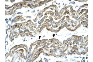 C13ORF8 antibody was used for immunohistochemistry at a concentration of 4-8 ug/ml to stain Skeletal muscle cells (arrows] in Human Muscle. (ZNF828 anticorps  (Middle Region))
