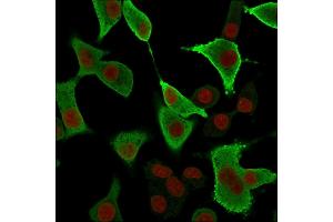 Immunofluorescence Analysis of A549 cells labeling AKR1B1 with AKR1B1 Mouse Monoclonal Antibody (CPTC-AKR1B1-3) followed by Goat anti-Mouse IgG-CF488 (Green).