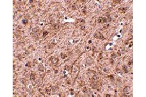 Immunohistochemistry of LASS6 in mouse brain tissue with LASS6 polyclonal antibody  at 2. (CERS6 anticorps  (N-Term))
