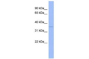 WB Suggested Anti-WNT5B Antibody Titration:  0. (WNT5B anticorps  (Middle Region))
