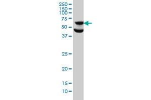 RPS6KB1 monoclonal antibody (M01), clone 1E12 Western Blot analysis of RPS6KB1 expression in HeLa .