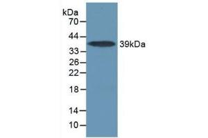 Detection of Recombinant IL17RA, Mouse using Polyclonal Antibody to Interleukin 17 Receptor A (IL17RA) (IL17RA anticorps  (AA 590-848))