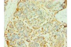 Immunohistochemistry of paraffin-embedded human pancreatic tissue using ABIN7145070 at dilution of 1:100 (COQ8A anticorps  (AA 1-220))