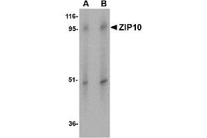 Western Blotting (WB) image for anti-Solute Carrier Family 39 (Zinc Transporter), Member 10 (SLC39A10) (Middle Region) antibody (ABIN1031175) (SLC39A10 anticorps  (Middle Region))