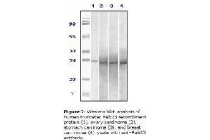 Image no. 2 for anti-RAB25, Member RAS Oncogene Family (RAB25) antibody (ABIN207613) (RAB25 anticorps)
