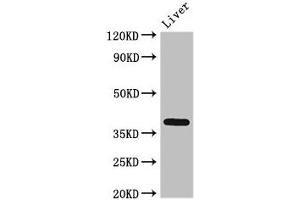 Western Blot Positive WB detected in: Rat liver tissue All lanes: ETV7 antibody at 3 μg/mL Secondary Goat polyclonal to rabbit IgG at 1/50000 dilution Predicted band size: 39, 33, 31, 37, 30, 23 kDa Observed band size: 39 kDa (ETV7 anticorps  (AA 134-218))