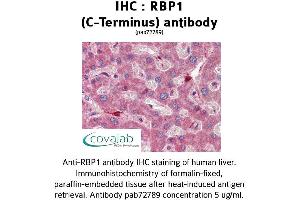 Image no. 2 for anti-Retinol Binding Protein 1, Cellular (RBP1) (C-Term) antibody (ABIN1738770) (RBP1 anticorps  (C-Term))