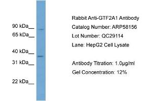 WB Suggested Anti-GTF2A1  Antibody Titration: 0. (GTF2A1 anticorps  (Middle Region))