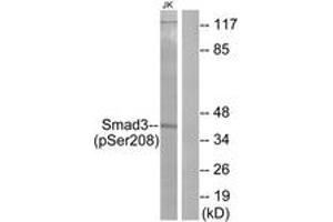 Western blot analysis of extracts from Jurkat cells, using Smad3 (Phospho-Ser208) Antibody.
