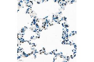 Immunohistochemistry of paraffin embedded rat lung using UBE3A (ABIN7076104) at dilution of 1:1000 (400x lens) (ube3a anticorps)