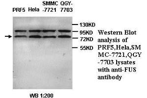 Image no. 1 for anti-Fused in Sarcoma (FUS) (C-Term) antibody (ABIN791042) (FUS anticorps  (C-Term))