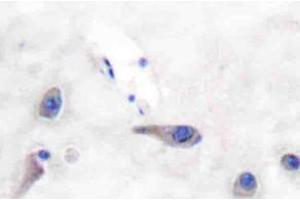 Immunohistochemistry (IHC)analyzes of MARCKS antibody in paraffin-embedded human brain tissue. (MARCKS anticorps)