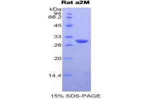 SDS-PAGE (SDS) image for alpha-2-Macroglobulin (A2M) (AA 216-437) protein (His tag) (ABIN1877362)