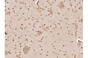 Paraformaldehyde-fixed, paraffin embedded Mouse brain Antigen retrieval by boiling in sodium citrate buffer (pH6.