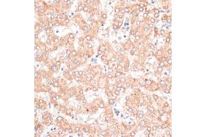 Immunohistochemistry of paraffin-embedded human liver using ABCB7 antibody (ABIN6291732) at dilution of 1:100 (40x lens). (ABCB7 anticorps)
