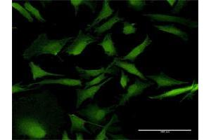 Immunofluorescence of purified MaxPab antibody to RAB31 on HeLa cell.