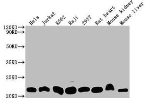 Western Blot Positive WB detected in: Hela whole cell lysate, Jurkat whole cell lysate, K562 whole cell lysate, Raji whole cell lysate, 293T whole cell lysate, Rat heart tissue, Mouse kidney tissue, Mouse liver tissue All lanes: DHFR antibody at 1:2000 Secondary Goat polyclonal to rabbit IgG at 1/50000 dilution Predicted band size: 22, 16 kDa Observed band size: 22 kDa (Recombinant Dihydrofolate Reductase anticorps)