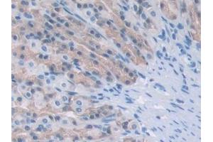 Detection of PPARg in Rat Stomach Tissue using Monoclonal Antibody to Peroxisome Proliferator Activated Receptor Gamma (PPARg)