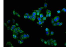 Immunofluorescence staining of PC-3 cells with ABIN7160347 at 1:133, counter-stained with DAPI.