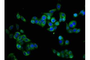 Immunofluorescence staining of PC-3 cells with ABIN7160347 at 1:133, counter-stained with DAPI. (CHRM3 anticorps  (AA 253-492))