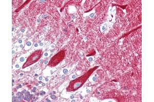 Anti-CPE antibody IHC of human brain, cerebellum.