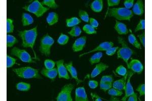 IF analysis of ACADM/MCAD using anti-ACADM/MCAD antibody (ABIN7601543). (Medium-Chain Specific Acyl-CoA Dehydrogenase, Mitochondrial (MCAD) (AA 38-401) anticorps)