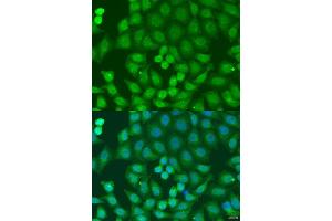 Immunofluorescence analysis of U2OS cells using ZFYVE16 antibody (ABIN6129169, ABIN6150439, ABIN6150441 and ABIN6223717) at dilution of 1:100.