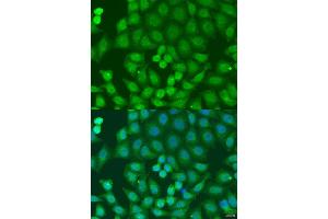 Immunofluorescence analysis of U2OS cells using ZFYVE16 antibody (ABIN6129169, ABIN6150439, ABIN6150441 and ABIN6223717) at dilution of 1:100. (ZFYVE16 anticorps  (AA 1-280))