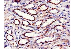 Immunohistochemistry of paraffin-embedded human kidney tissue using ABIN7152982 at dilution of 1:100 (FAK anticorps  (AA 363-464))