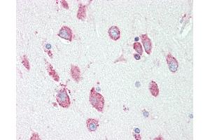 Anti-HEXA antibody IHC staining of human brain, cortex.