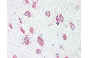 Anti-HEXA antibody IHC staining of human brain, cortex. (Hexosaminidase A anticorps  (AA 142-170))