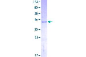 Image no. 1 for NADH Dehydrogenase (Ubiquinone) 1 alpha Subcomplex, 13 (NDUFA13) (AA 1-144) protein (GST tag) (ABIN1312215)