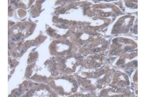 Detection of VARS in Mouse Stomach Tissue using Polyclonal Antibody to Valyl tRNA Synthetase (VARS)