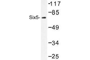 Image no. 1 for anti-Homeobox protein SIX5 (SIX5) antibody (ABIN317916) (Six5 anticorps)