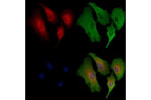ABIN6258462 and ABIN6273867 staining  cells by IF/ICC.