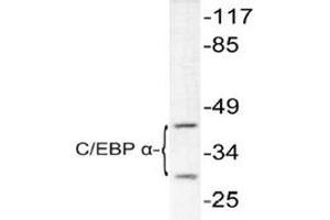 Image no. 1 for anti-CCAAT/enhancer Binding Protein (C/EBP), alpha (CEBPA) antibody (ABIN271872)
