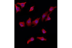 ABIN6263142 and ABIN6272924 staining HepG2 by IF/ICC. (MAT2B anticorps  (Internal Region))