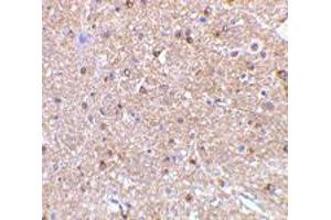 Immunohistochemistry of RTN4 in mouse brain tissue with RTN4 polyclonal antibody  at 2. (Reticulon 4 anticorps  (Internal Region))