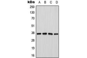 Western blot analysis of Cathepsin H expression in Jurkat (A), K562 (B), mouse kidney (C), PC12 (D) whole cell lysates. (Cathepsin H anticorps  (Center))