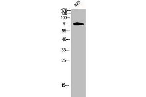 Western Blot analysis of 823 cells using Phospho-PKC ζ (T410) Polyclonal Antibody