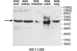 Western blot analysis of various fetal tissue, using AMN antibody. (AMN anticorps  (Middle Region))