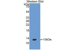 Western blot analysis of the recombinant protein. (PIGR anticorps  (AA 343-447))