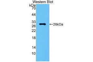 Detection of Recombinant CA2, Gallus using Polyclonal Antibody to Carbonic Anhydrase II (CA2) (CA2 anticorps  (AA 1-260))