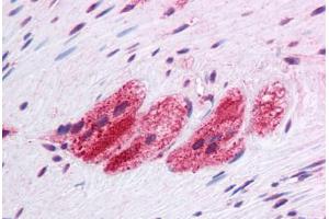 Human Colon, Myenteric Plexus: Formalin-Fixed, Paraffin-Embedded (FFPE)
